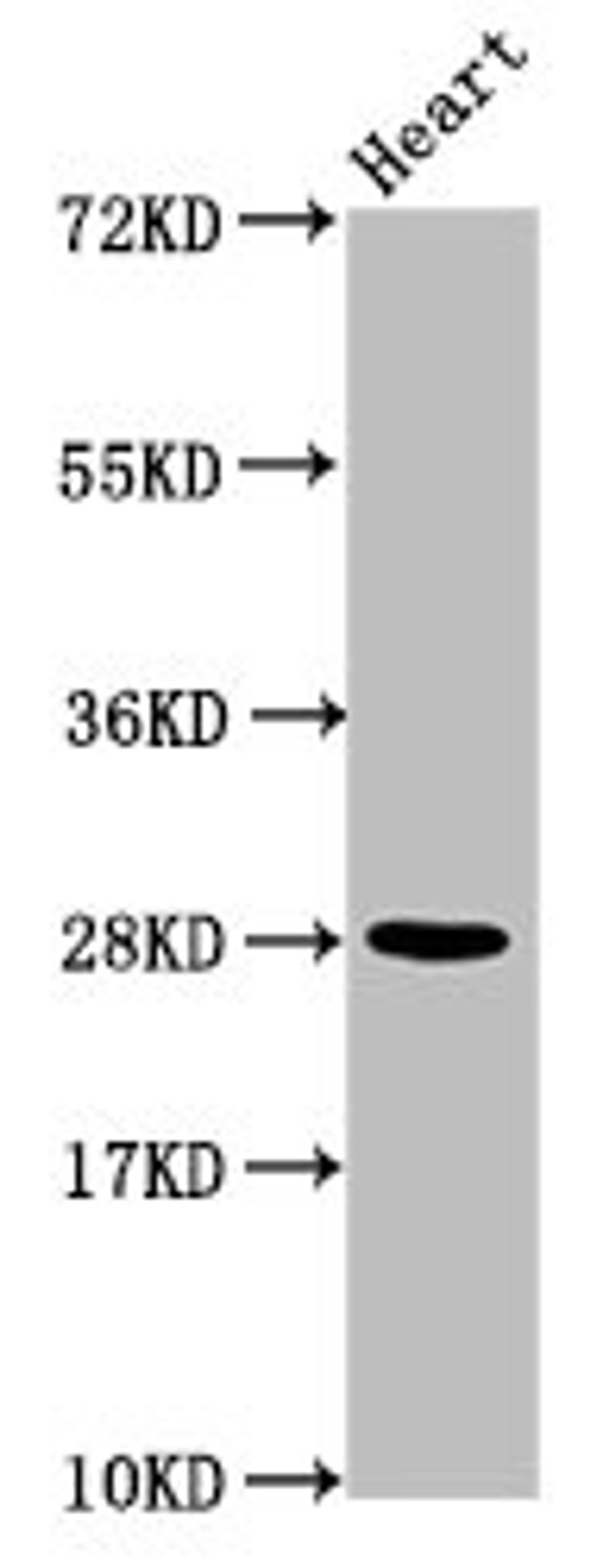 Western Blot. Positive WB detected in: Mouse heart tissue. All lanes: HIST1H2AG antibody at 1.04µg/ml. Secondary. Goat polyclonal to rabbit IgG at 1/50000 dilution. Predicted band size: 15 kDa. Observed band size: 28 kDa