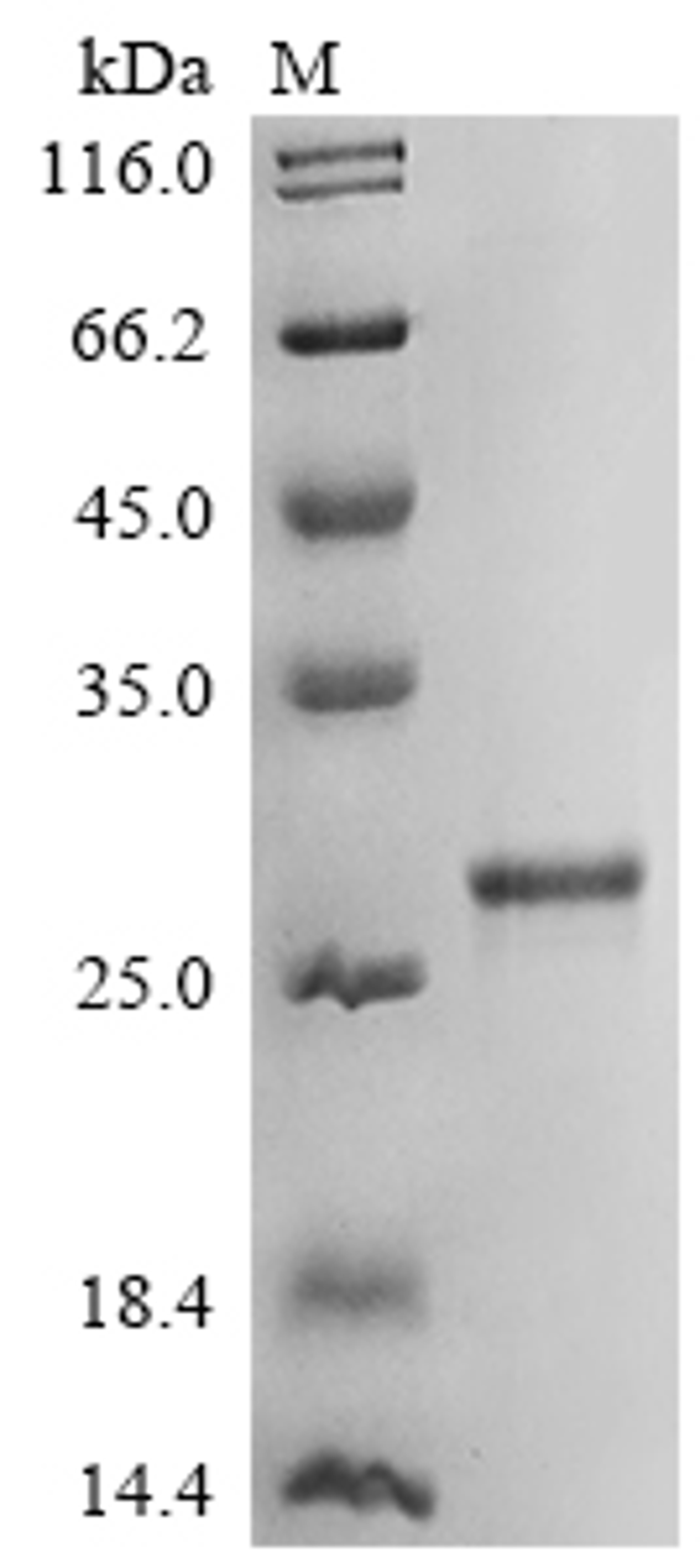 (Tris-Glycine gel) Discontinuous SDS-PAGE (reduced) with 5% enrichment gel and 15% separation gel.