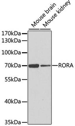 Western blot - RORA antibody (A6971)