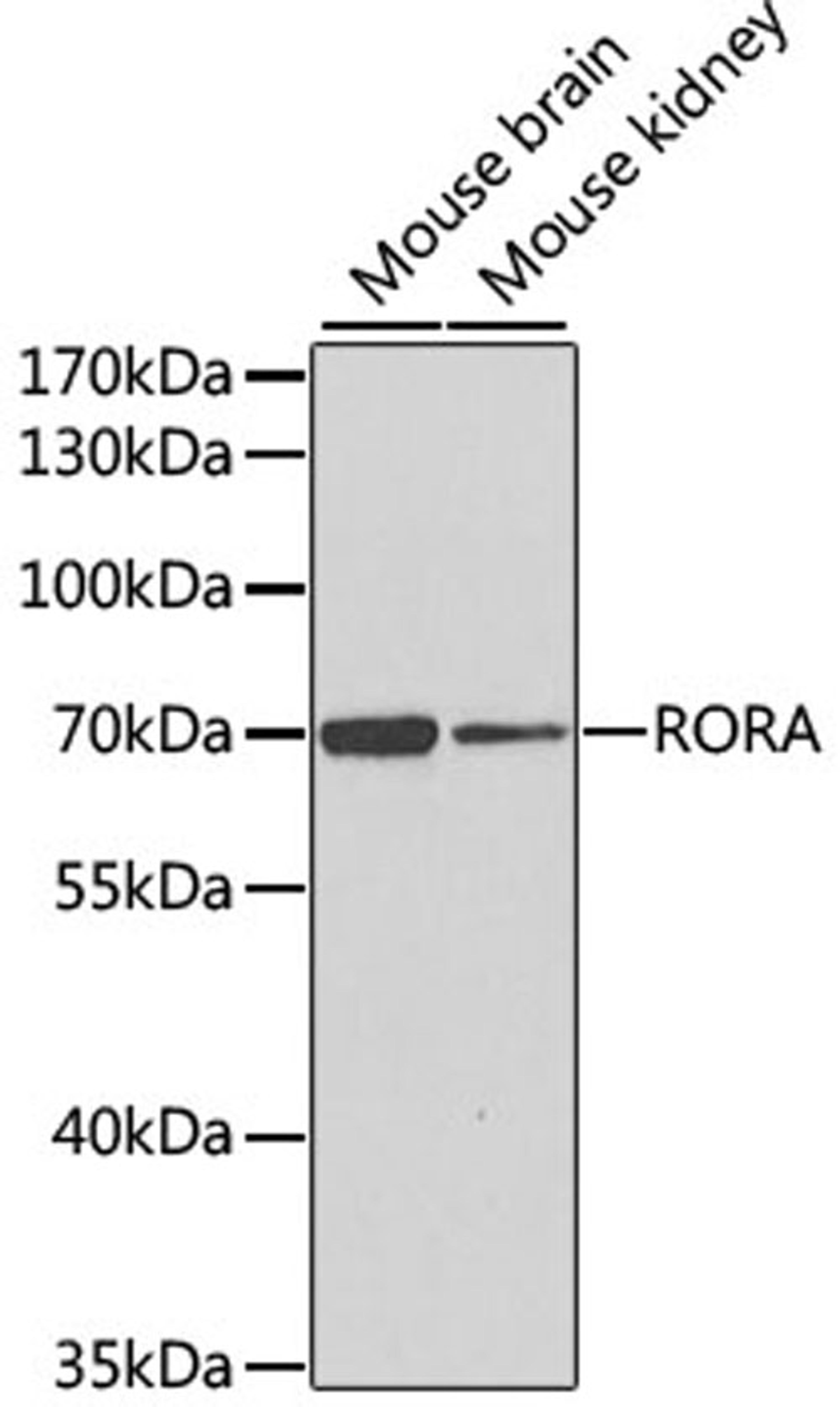 Western blot - RORA antibody (A6971)