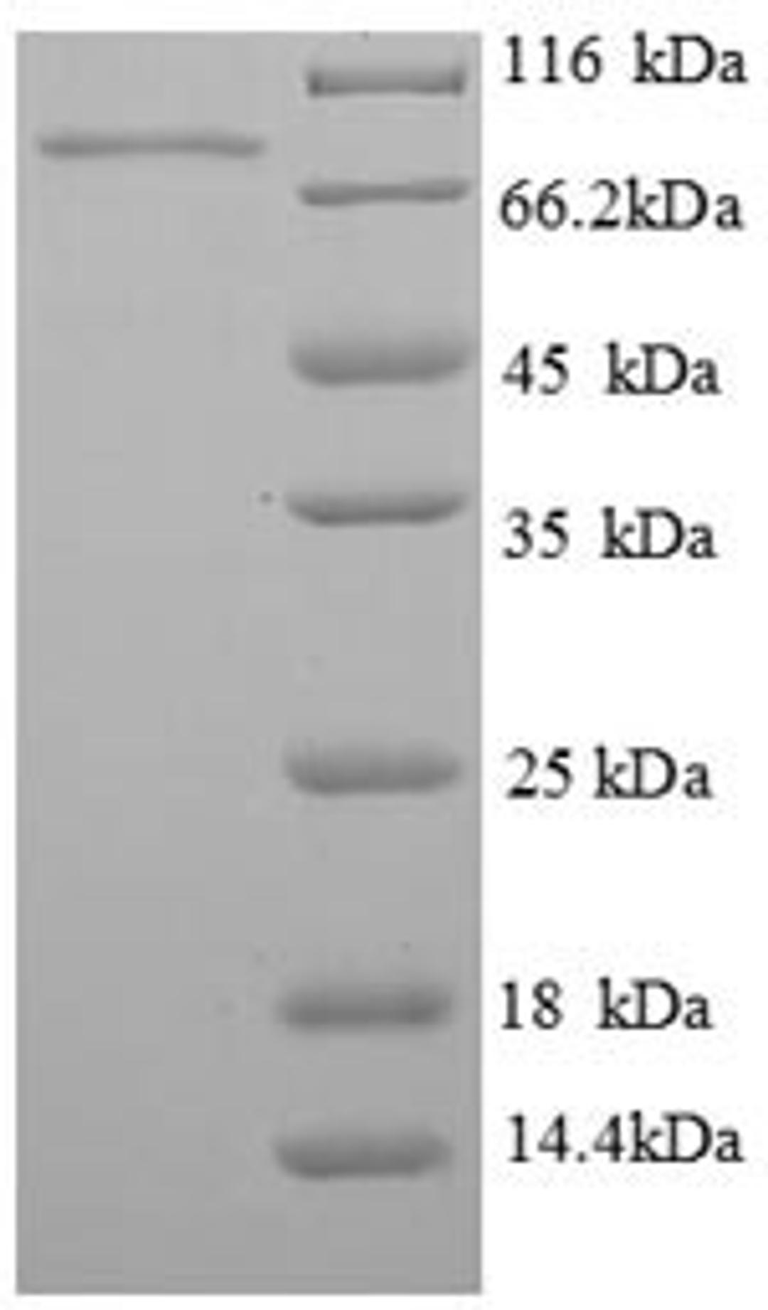 (Tris-Glycine gel) Discontinuous SDS-PAGE (reduced) with 5% enrichment gel and 15% separation gel.
