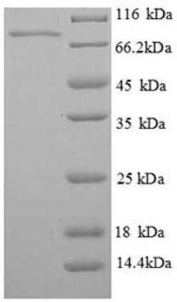 (Tris-Glycine gel) Discontinuous SDS-PAGE (reduced) with 5% enrichment gel and 15% separation gel.