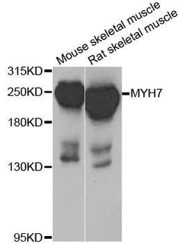 Western blot analysis of extracts of various cell lines using MYH7 antibody