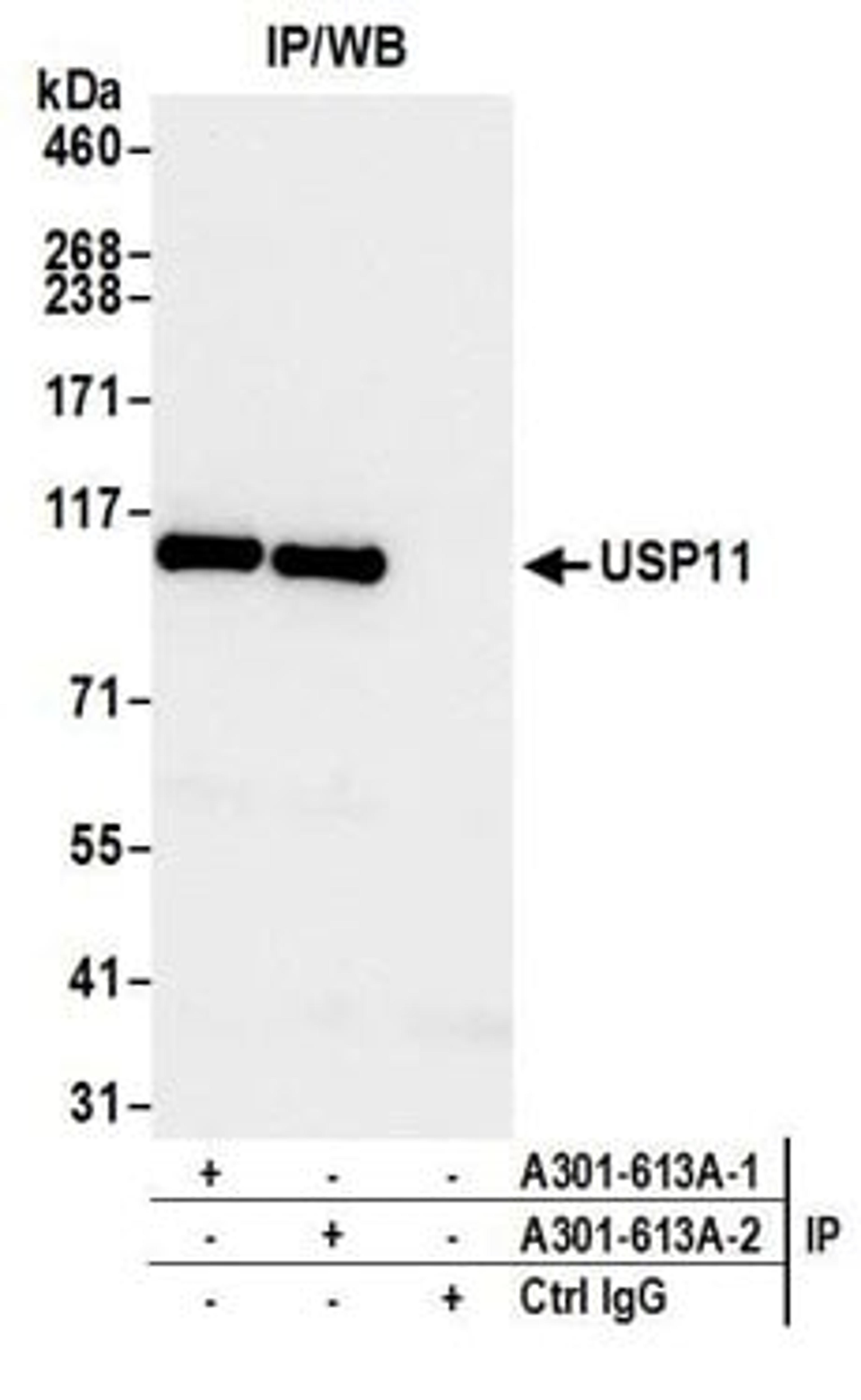 Detection of human USP11 by western blot of immunoprecipitates.