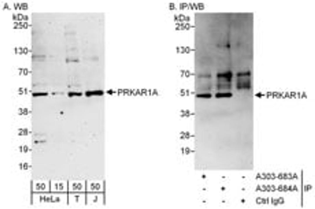 Detection of human PRKAR1A by western blot and immunoprecipitation.