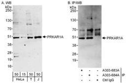 Detection of human PRKAR1A by western blot and immunoprecipitation.