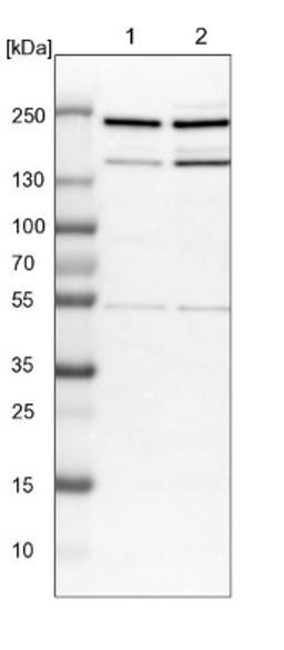 Western Blot: CDC42BPB Antibody [NBP1-81440] - Lane 1: NIH-3T3 cell lysate (Mouse embryonic fibroblast cells)<br/>Lane 2: NBT-II cell lysate (Rat Wistar bladder tumour cells)