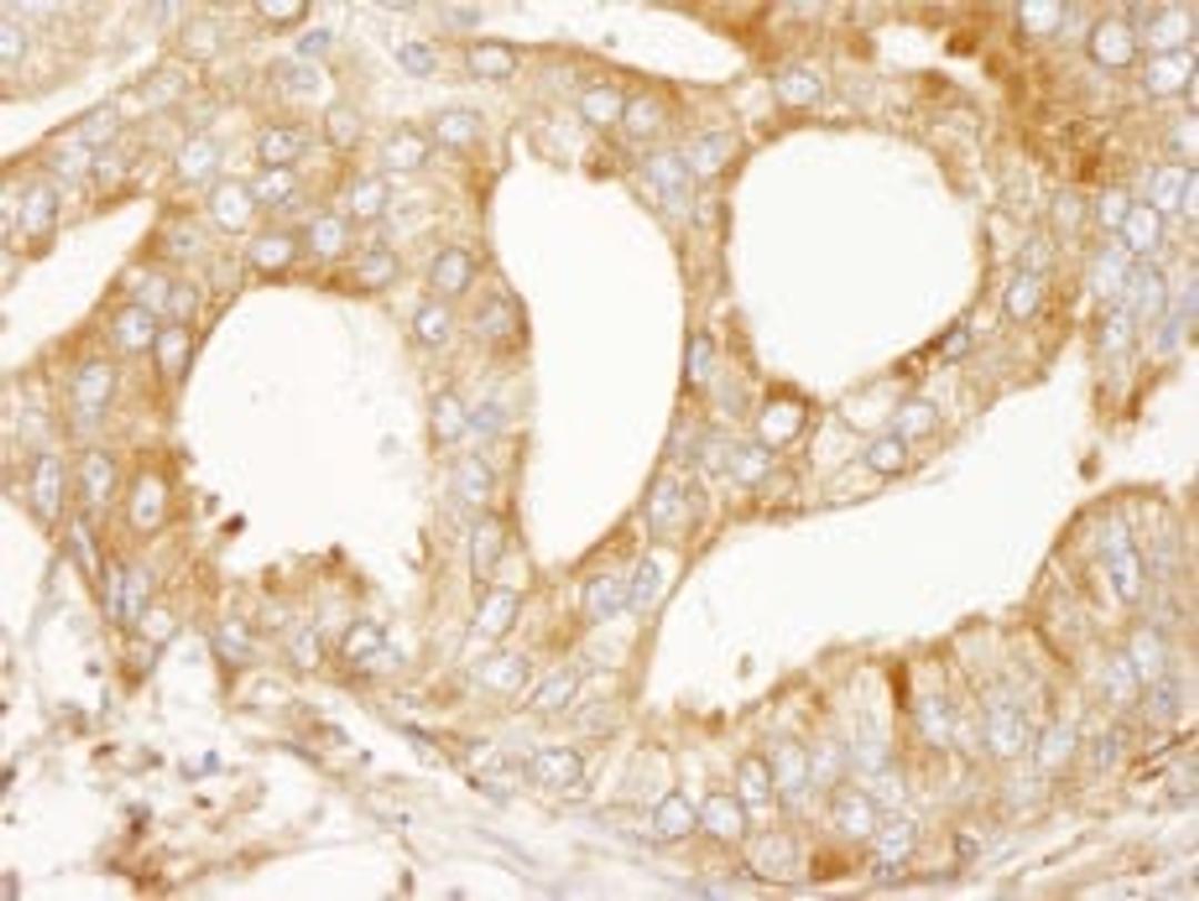 Detection of human MAP4 immunohistochemistry.