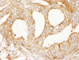 Detection of human MAP4 immunohistochemistry.