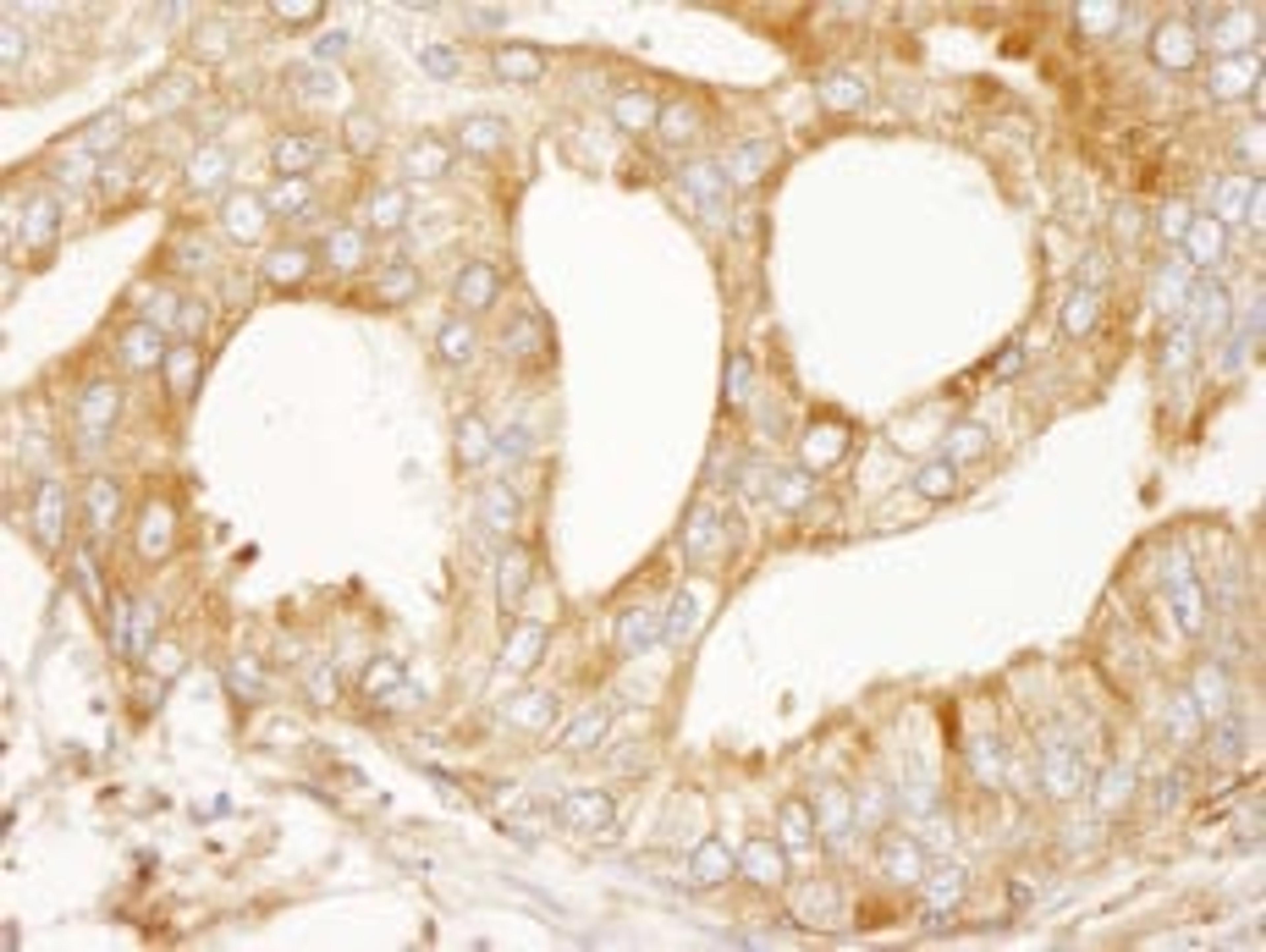 Detection of human MAP4 immunohistochemistry.