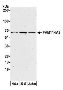 Detection of human FAM114A2 by WB.