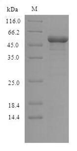 (Tris-Glycine gel) Discontinuous SDS-PAGE (reduced) with 5% enrichment gel and 15% separation gel.