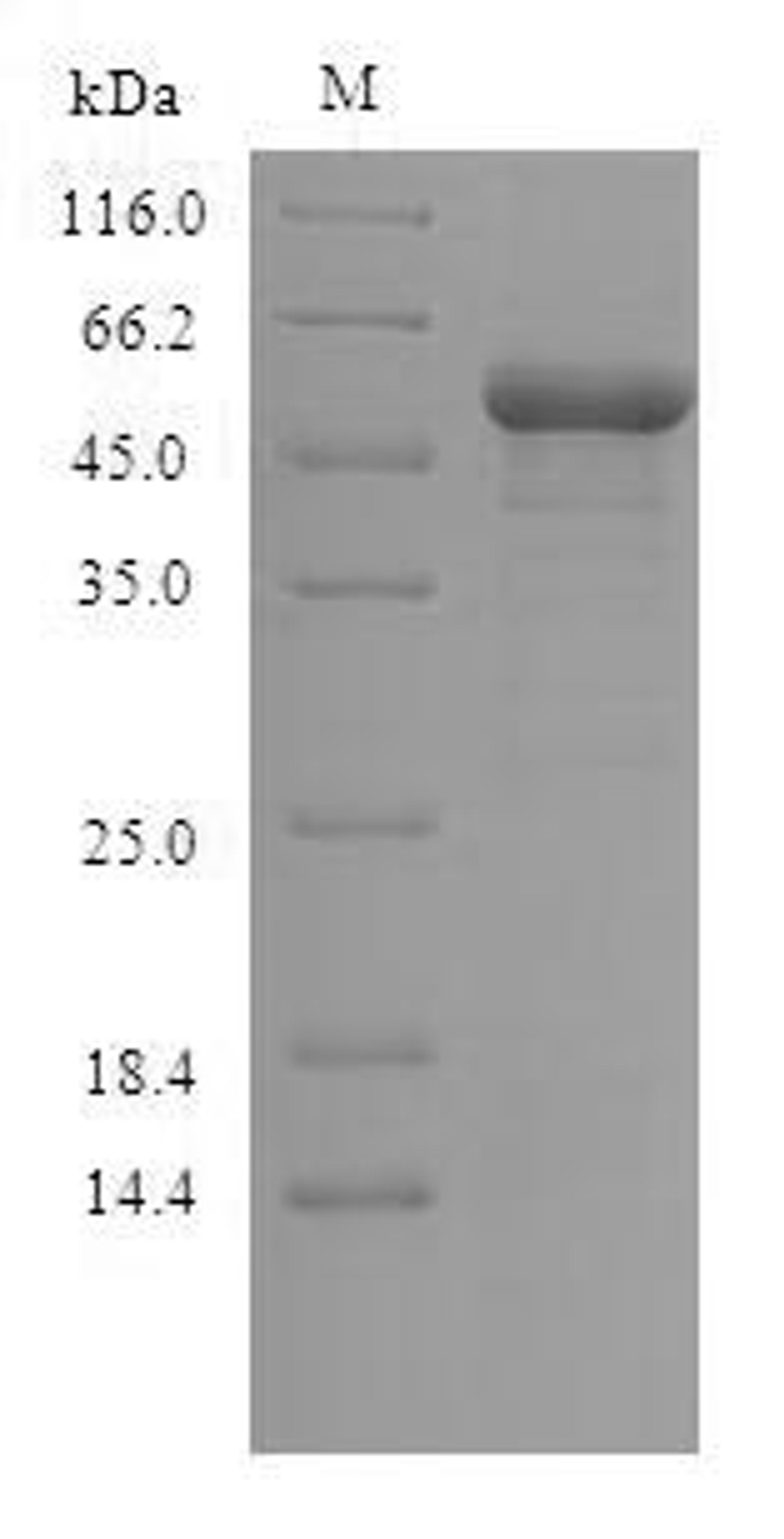 (Tris-Glycine gel) Discontinuous SDS-PAGE (reduced) with 5% enrichment gel and 15% separation gel.