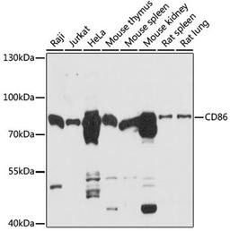 Western blot - CD86 antibody (A16805)