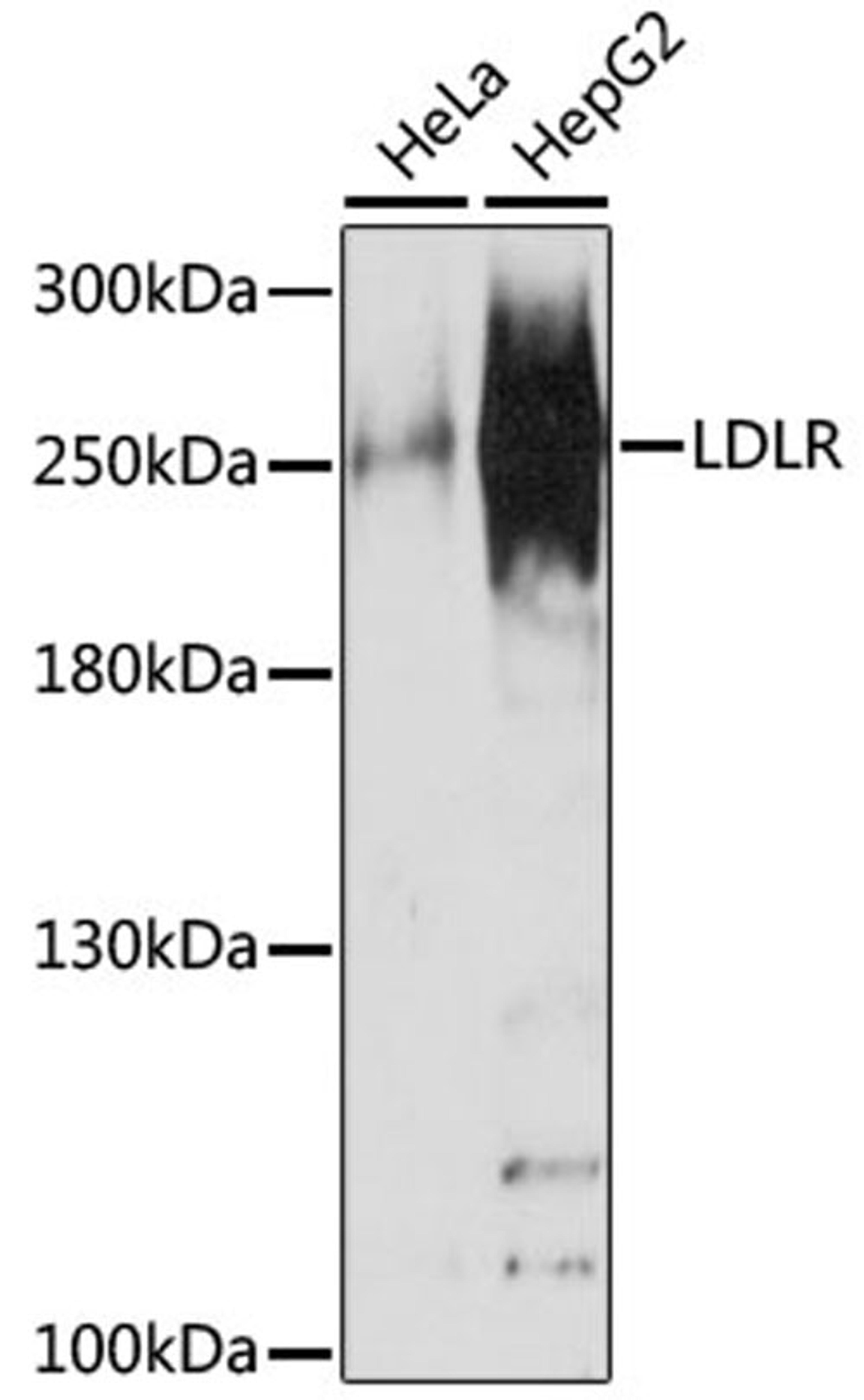 Western blot - NUP210 antibody (A16676)