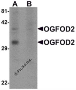 Western blot analysis of OGFOD2 in 293 cell lysate with OGFOD2 antibody at 1 μg/mL in (A) the absence and (B) the presence of blocking peptide.