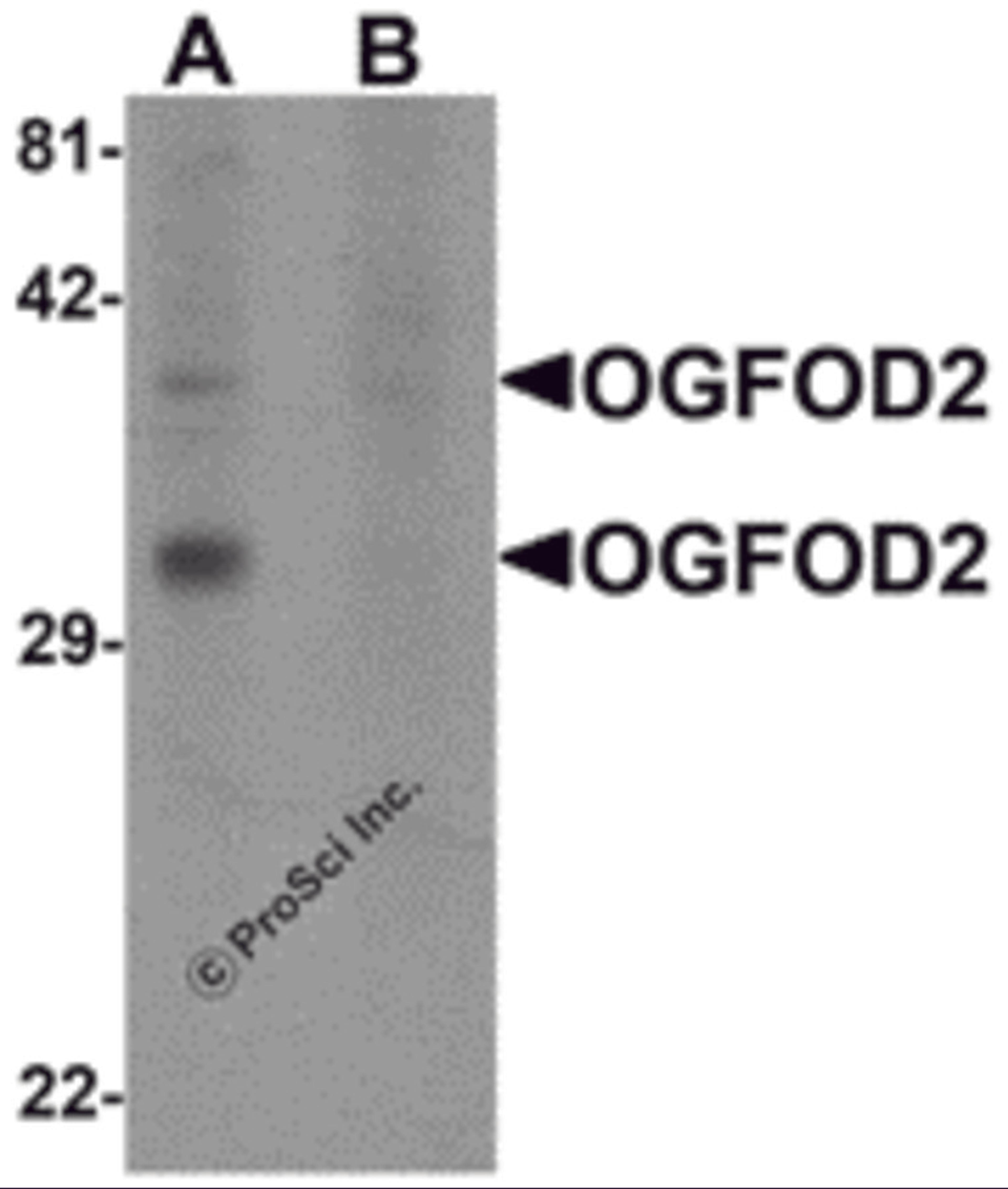 Western blot analysis of OGFOD2 in 293 cell lysate with OGFOD2 antibody at 1 μg/mL in (A) the absence and (B) the presence of blocking peptide.