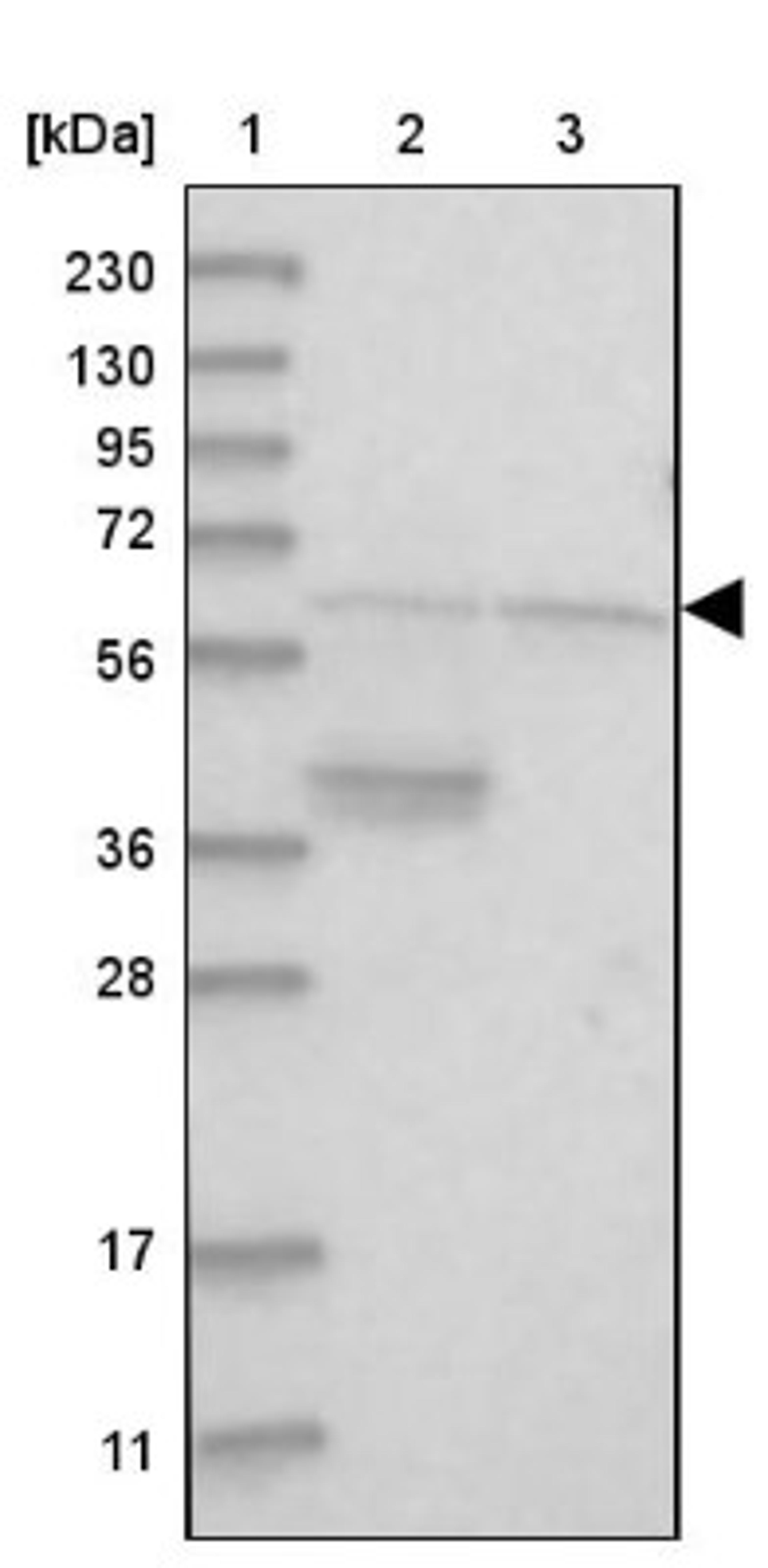 Western Blot: ACF Antibody [NBP1-90271] - Lane 1: Marker [kDa] 230, 130, 95, 72, 56, 36, 28, 17, 11<br/>Lane 2: Human cell line RT-4<br/>Lane 3: Human cell line U-251MG sp