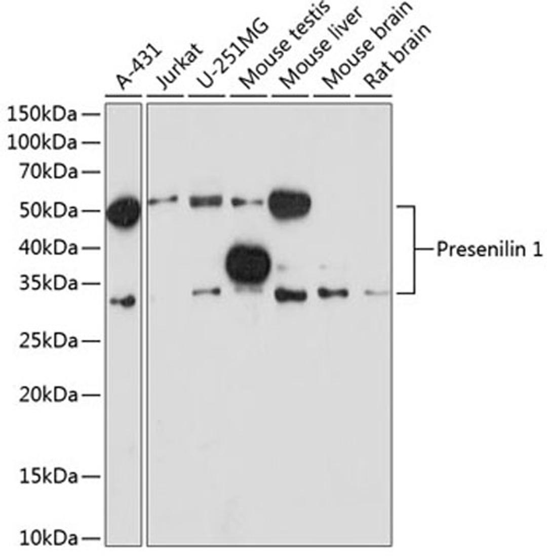 Western blot - Presenilin 1 antibody (A19103)