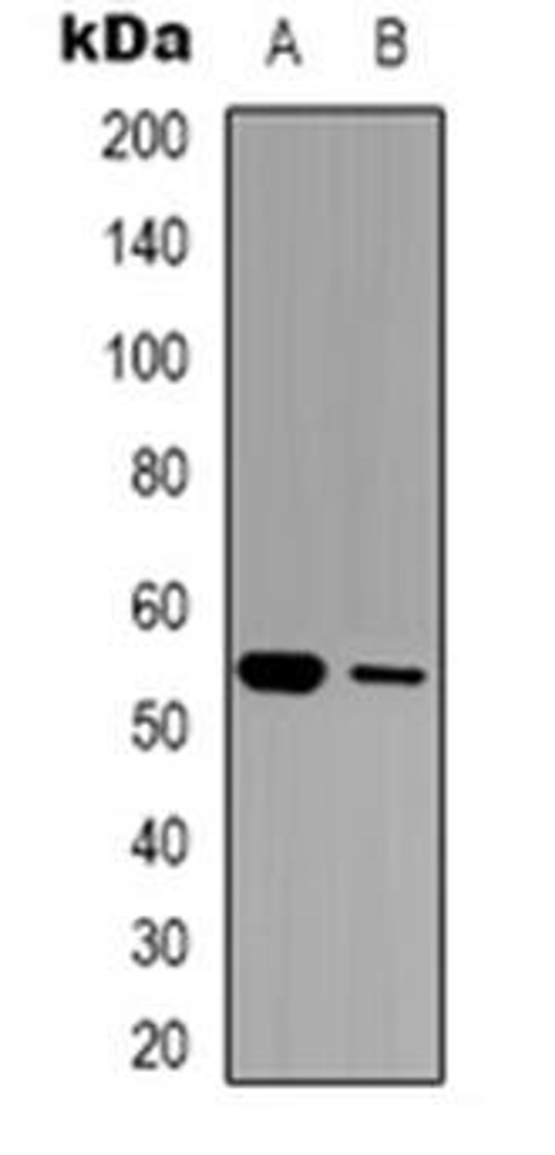 Western blot analysis of GABRG1 expression in LOVO (Lane 1), mouse brain (Lane 2) whole cell lysates using GABRG1 antibody