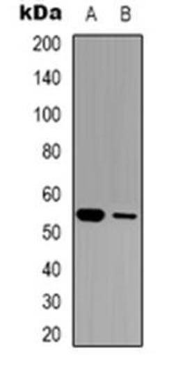 Western blot analysis of GABRG1 expression in LOVO (Lane 1), mouse brain (Lane 2) whole cell lysates using GABRG1 antibody