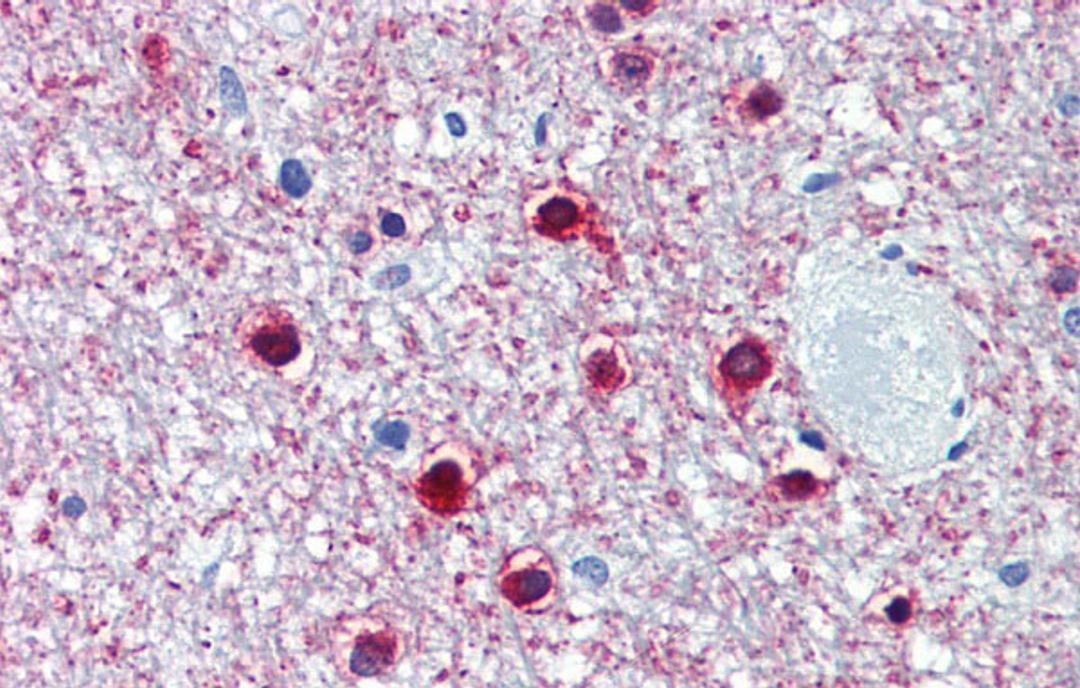 Antibody used in IHC on Human Brain, cerebellum at 5.0 ug/ml.