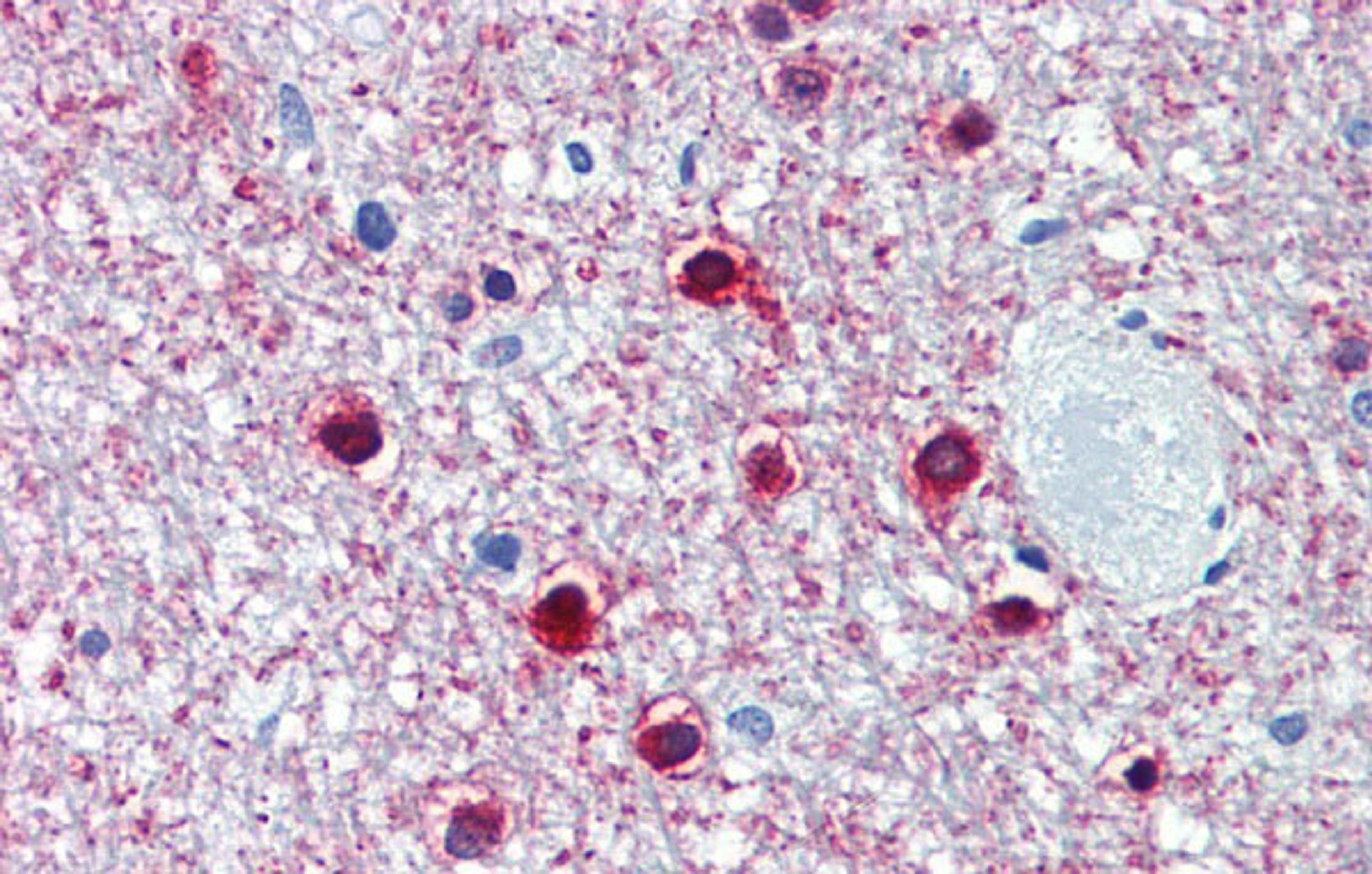 Antibody used in IHC on Human Brain, cerebellum at 5.0 ug/ml.