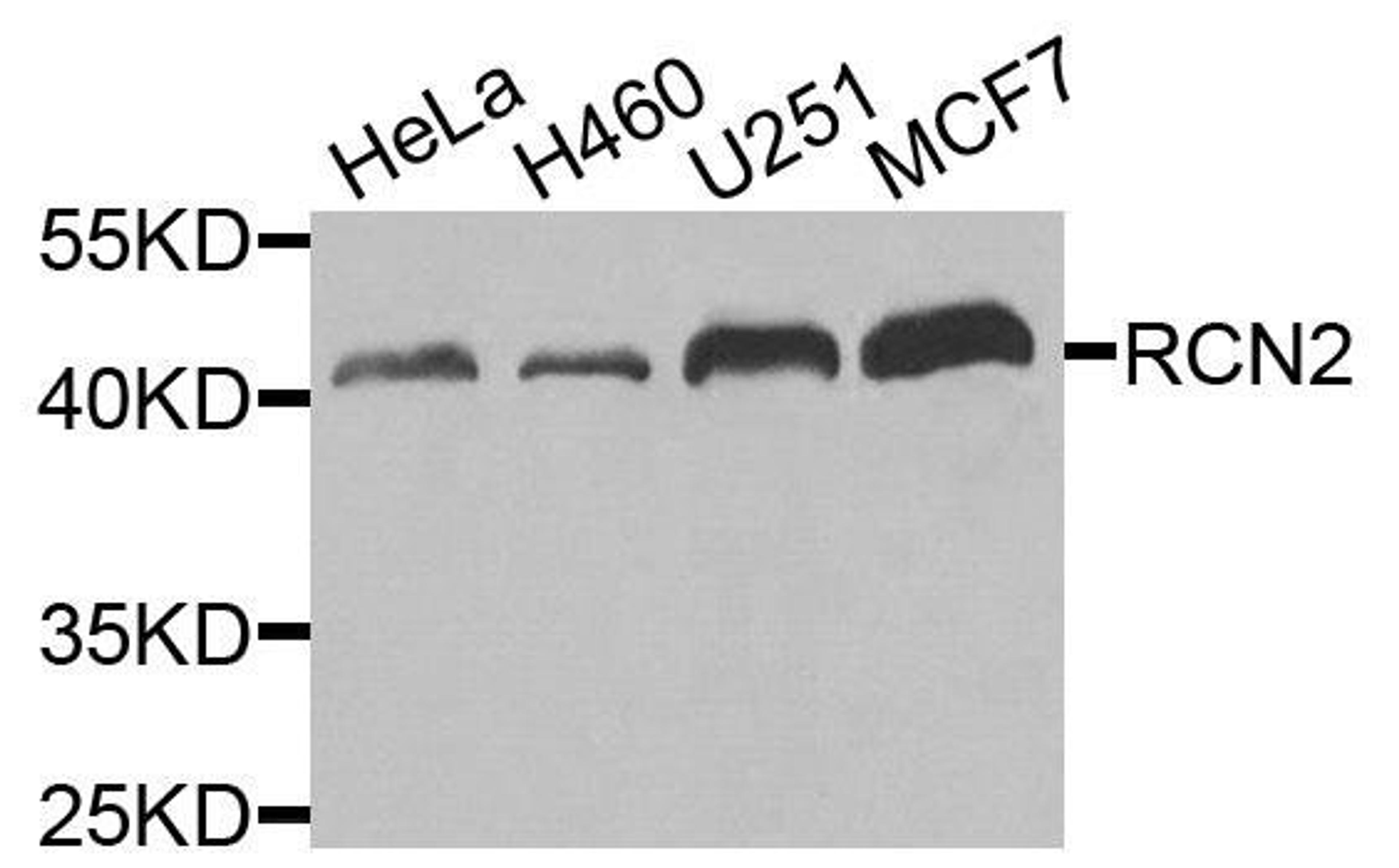 Western blot analysis of extracts of various cells using RCN2 antibody