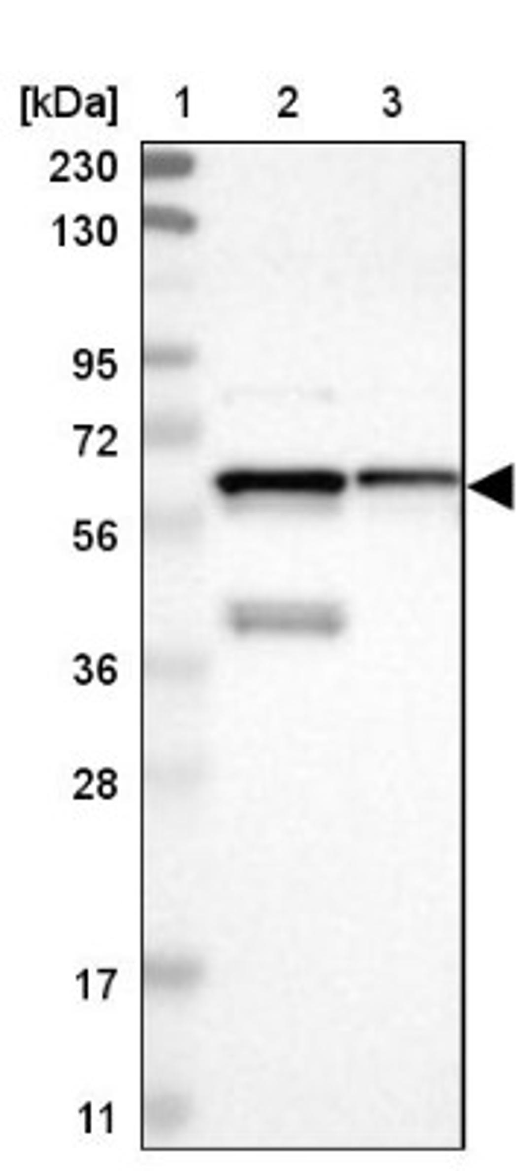 Western Blot: PTPIP51 Antibody [NBP1-84738] - Lane 1: Marker [kDa] 230, 130, 95, 72, 56, 36, 28, 17, 11<br/>Lane 2: Human cell line RT-4<br/>Lane 3: Human cell line U-251MG sp