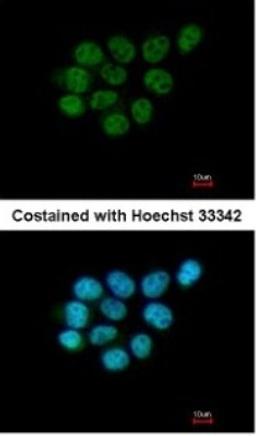 Immunocytochemistry/Immunofluorescence: ARIH2 Antibody [NBP1-31044] - Paraformaldehyde-fixed A431, using antibody at 1:200 dilution.