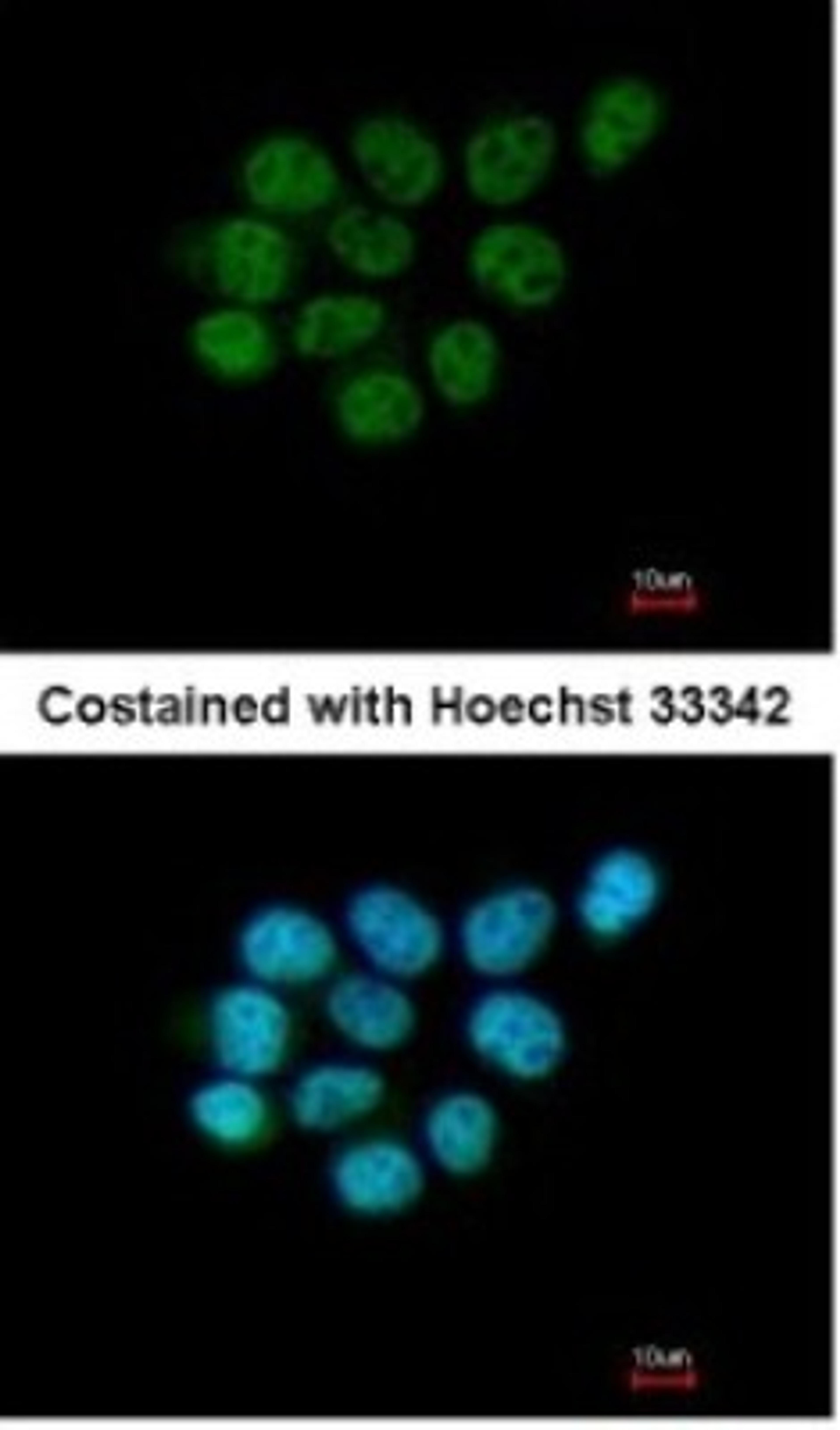 Immunocytochemistry/Immunofluorescence: ARIH2 Antibody [NBP1-31044] - Paraformaldehyde-fixed A431, using antibody at 1:200 dilution.