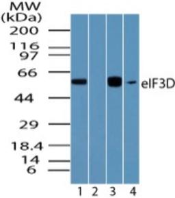 Western Blot: EIF3D Antibody [NBP2-24468] - Analysis of eIF3D in human brain lysate in the 1) absence and2) presence of immunizing peptide, 3) mouse brain and 4) rat brain lysateusing NBP2-24468 at 0.01 ug/ml, 0.01 ug/ml, 0.005 ug/ml and 0.01 ug/ml, respectively.