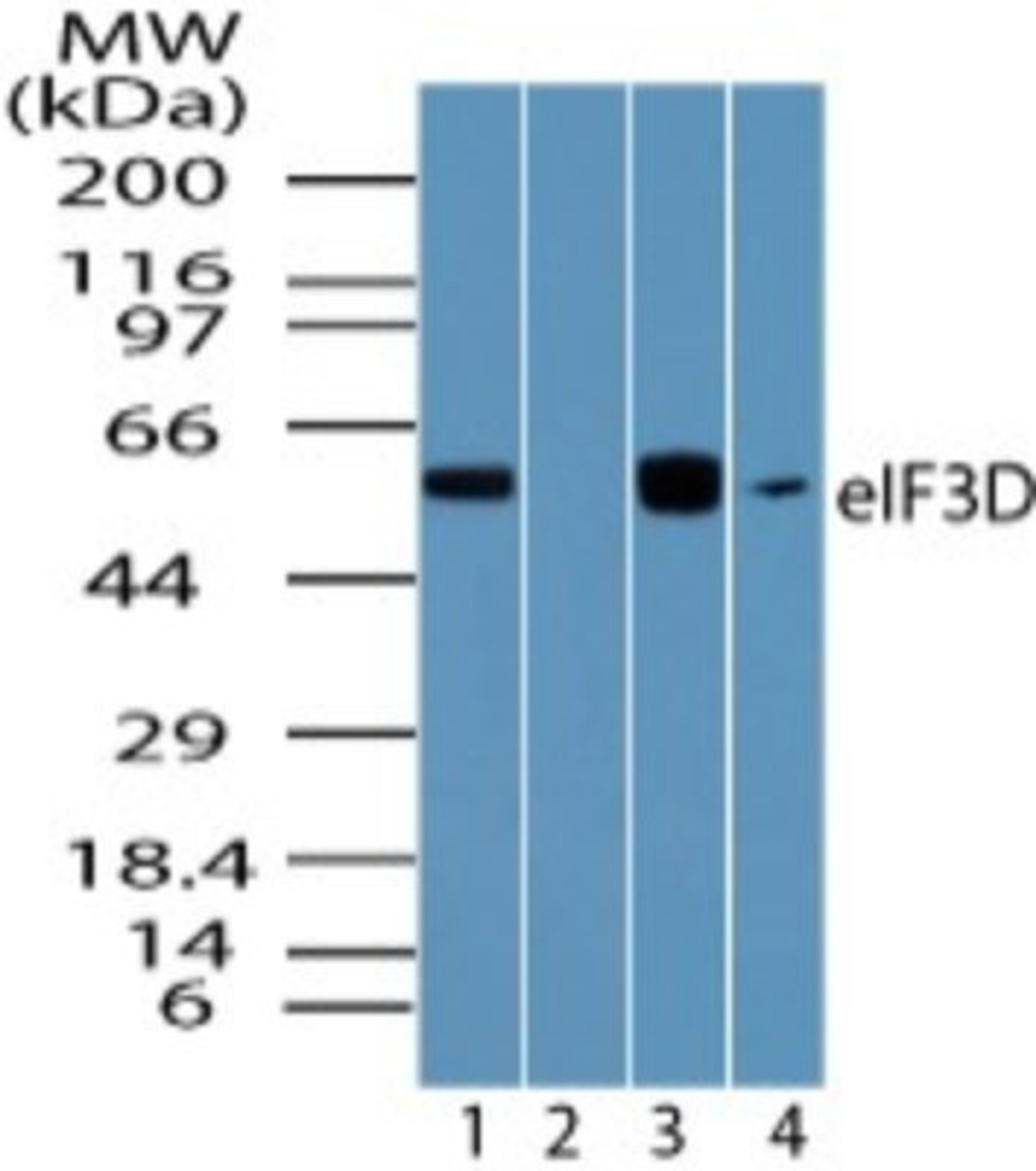 Western Blot: EIF3D Antibody [NBP2-24468] - Analysis of eIF3D in human brain lysate in the 1) absence and2) presence of immunizing peptide, 3) mouse brain and 4) rat brain lysateusing NBP2-24468 at 0.01 ug/ml, 0.01 ug/ml, 0.005 ug/ml and 0.01 ug/ml, respectively.