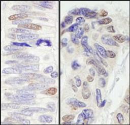 Detection of human Pescadillo by immunohistochemistry.