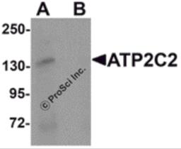 Western blot analysis of ATP2C2 in 3T3 cell lysate with ATP2C2 antibody at 1 μg/mL in (A) the absence and (B) the presence of blocking peptide.