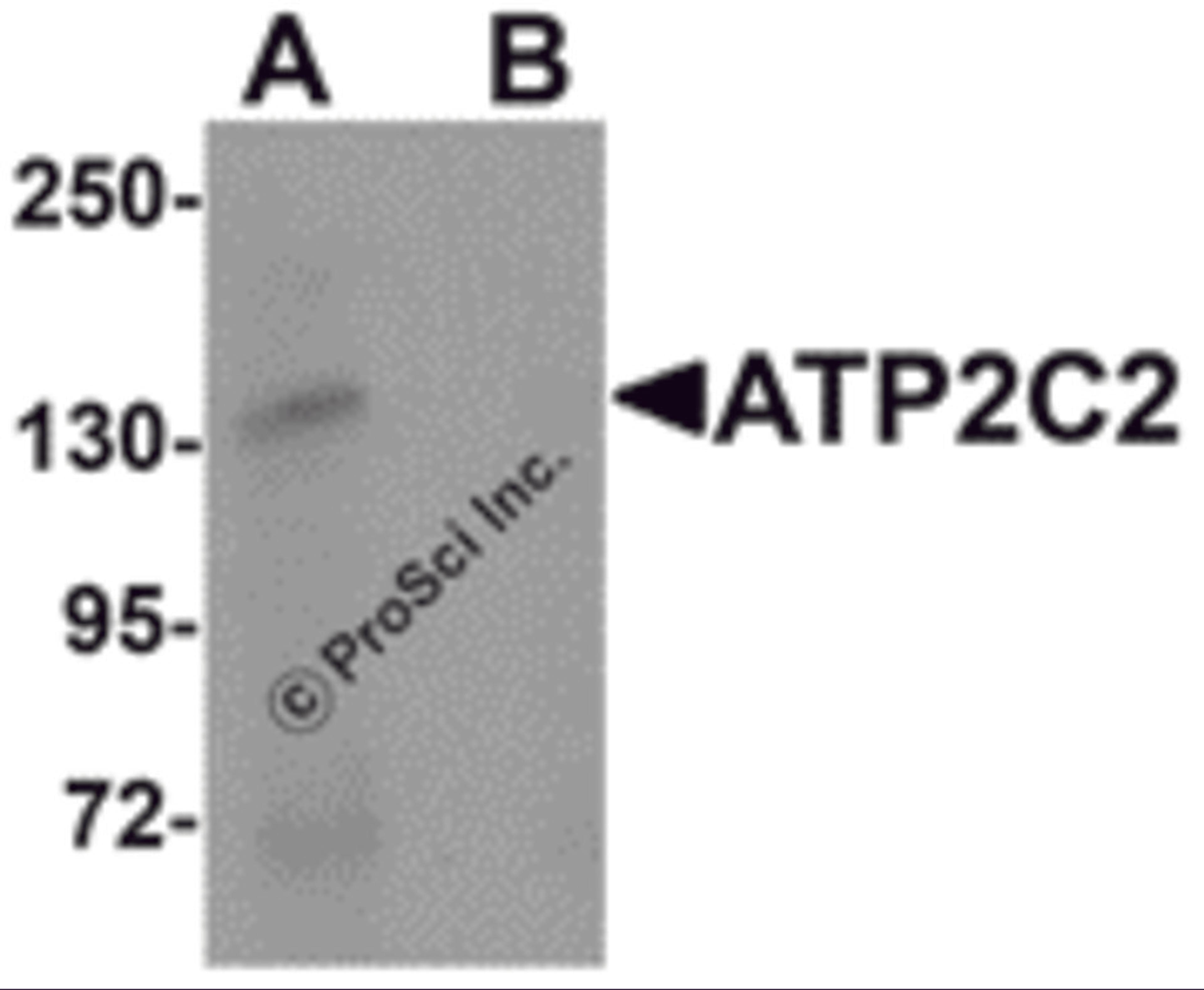 Western blot analysis of ATP2C2 in 3T3 cell lysate with ATP2C2 antibody at 1 μg/mL in (A) the absence and (B) the presence of blocking peptide.