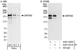 Detection of human ZNF592 by western blot and immunoprecipitation.