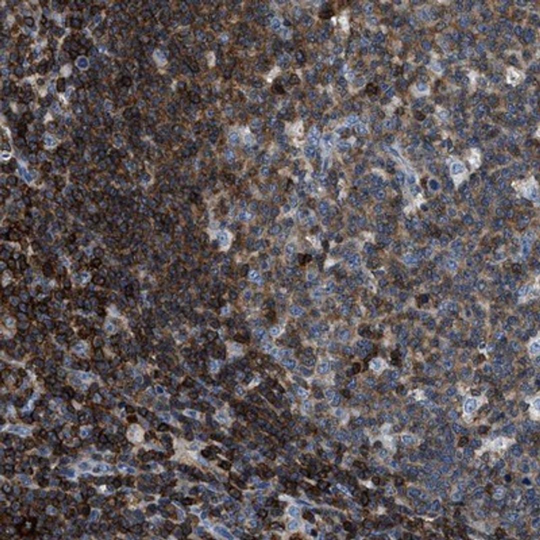 Immunohistochemistry-Paraffin: MYO1G Antibody [NBP1-93704] - Staining of human lymph node shows strong cytoplasmic positivity in lymphoid cells outside reaction centra.