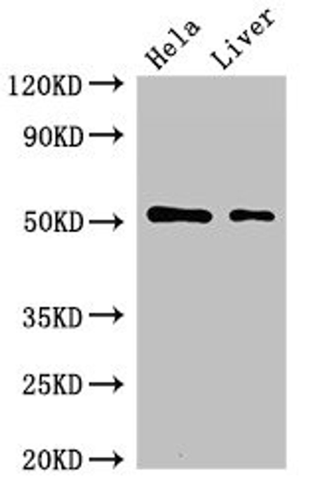 Western Blot. Positive WB detected in: Hela whole cell lysate, Rat liver tissue. All lanes: SLC10A3 antibody at 2µg/ml. Secondary. Goat polyclonal to rabbit IgG at 1/50000 dilution. Predicted band size: 51, 48 kDa. Observed band size: 51 kDa