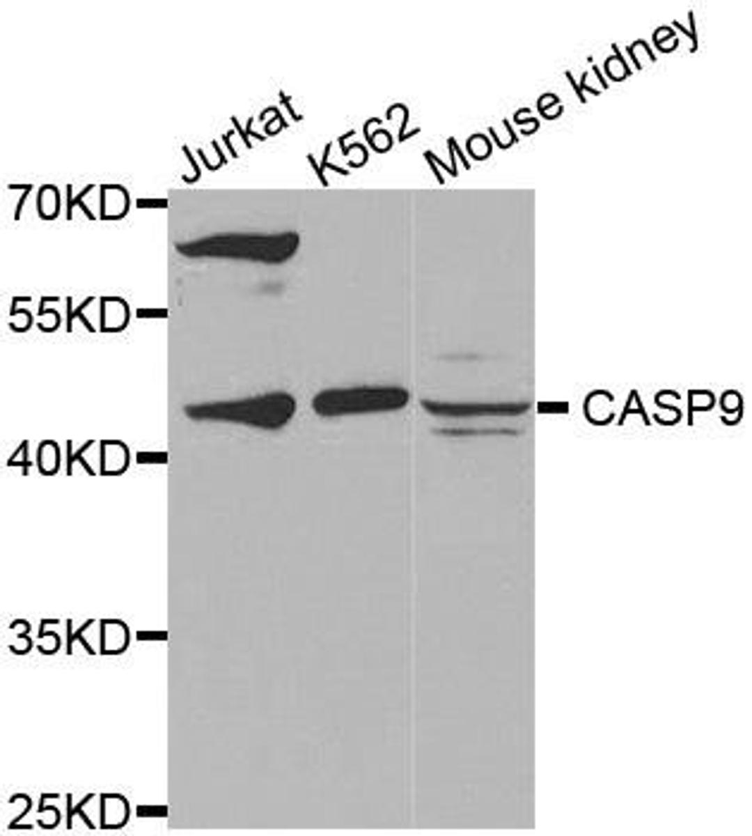 Western blot analysis of extracts of various cell lines using CASP9 antibody