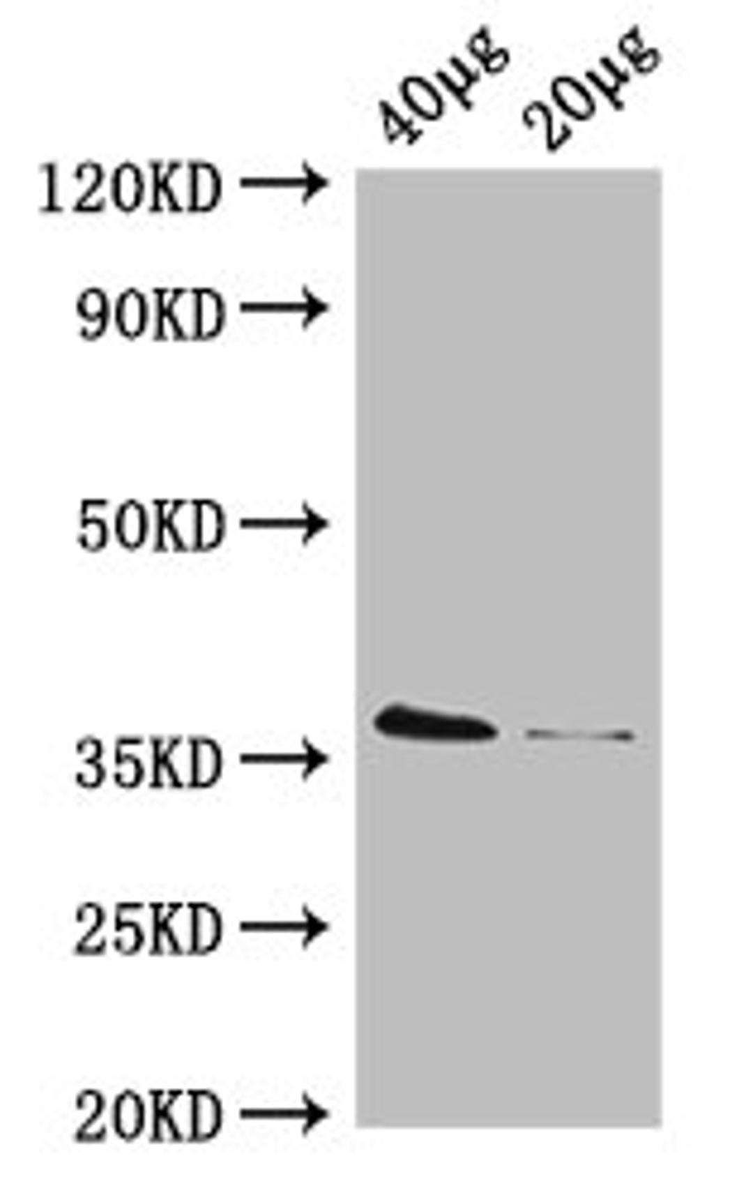 Western Blot. Positive WB detected in: Rosseta bacteria lysate at 40µg, 20µg. All lanes: dcyD antibody; HRP conjugated at 0.42µg/ml. Predicted band size: 36 kDa. Observed band size: 36 kDa