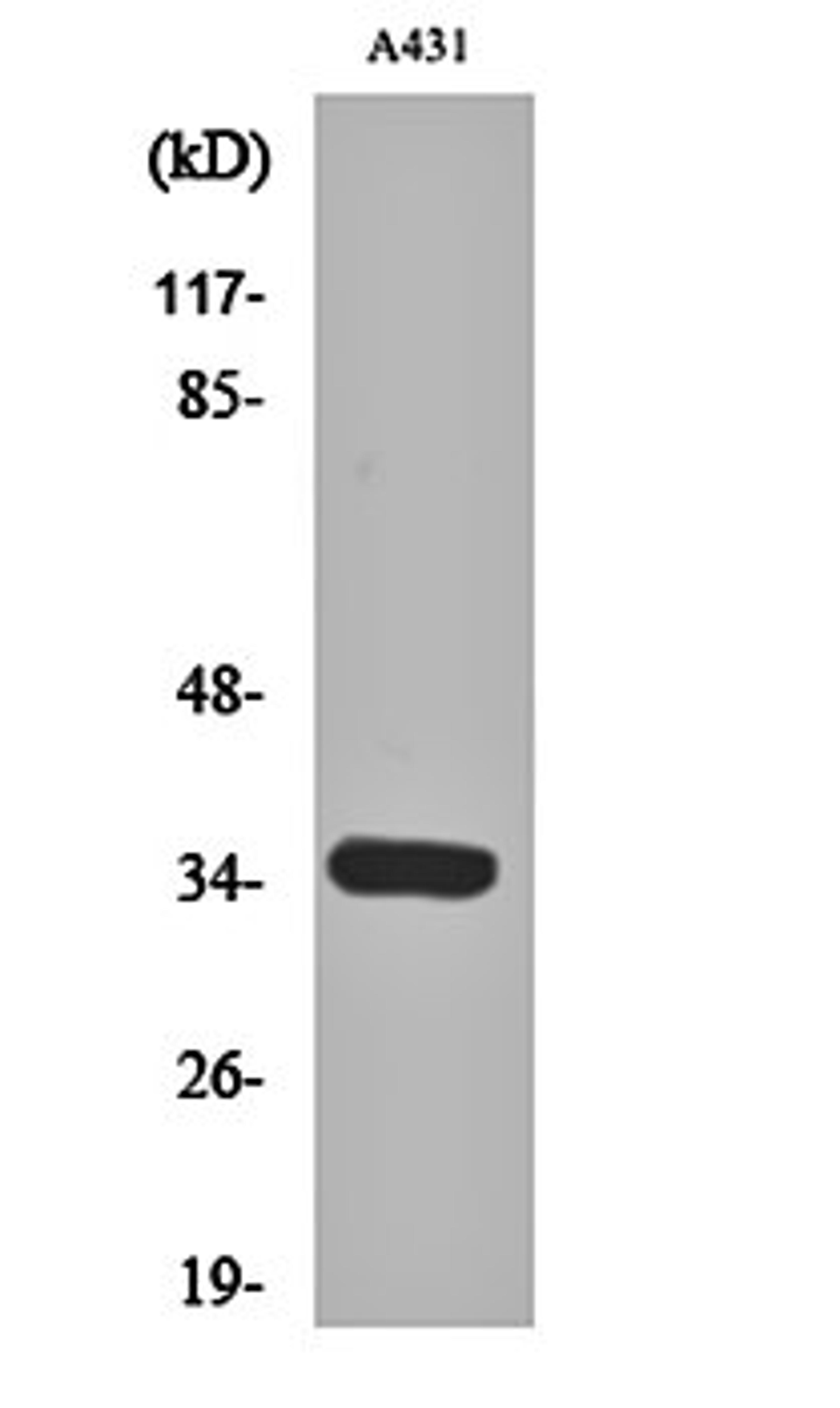 Western blot analysis of A431 cell lysates using Cdk2/Cdc2 antibody