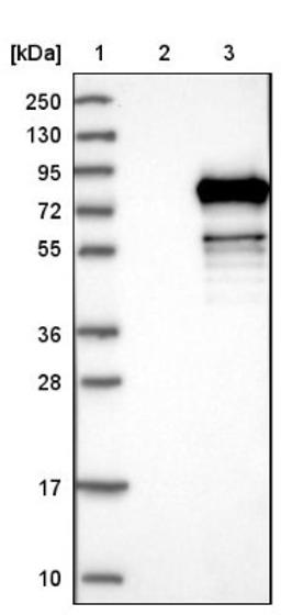 Western Blot: TIGD4 Antibody [NBP1-86303] - Lane 1: Marker [kDa] 250, 130, 95, 72, 55, 36, 28, 17, 10<br/>Lane 2: Negative control (vector only transfected HEK293T lysate)<br/>Lane 3: Over-expression lysate (Co-expressed with a C-terminal myc-DDK tag (~3.1 kDa) in mammalian HEK293T cells, LY407908)