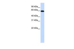 Antibody used in WB on Human Brain at 0.2-1 ug/ml.