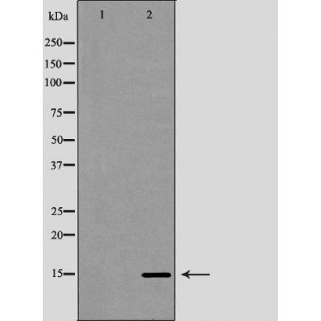 Western blot analysis of HeLa cell line and H3 protein expressed in E.coli using Histone H3R26me2a antibody