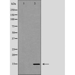 Western blot analysis of HeLa cell line and H3 protein expressed in E.coli using Histone H3R26me2a antibody