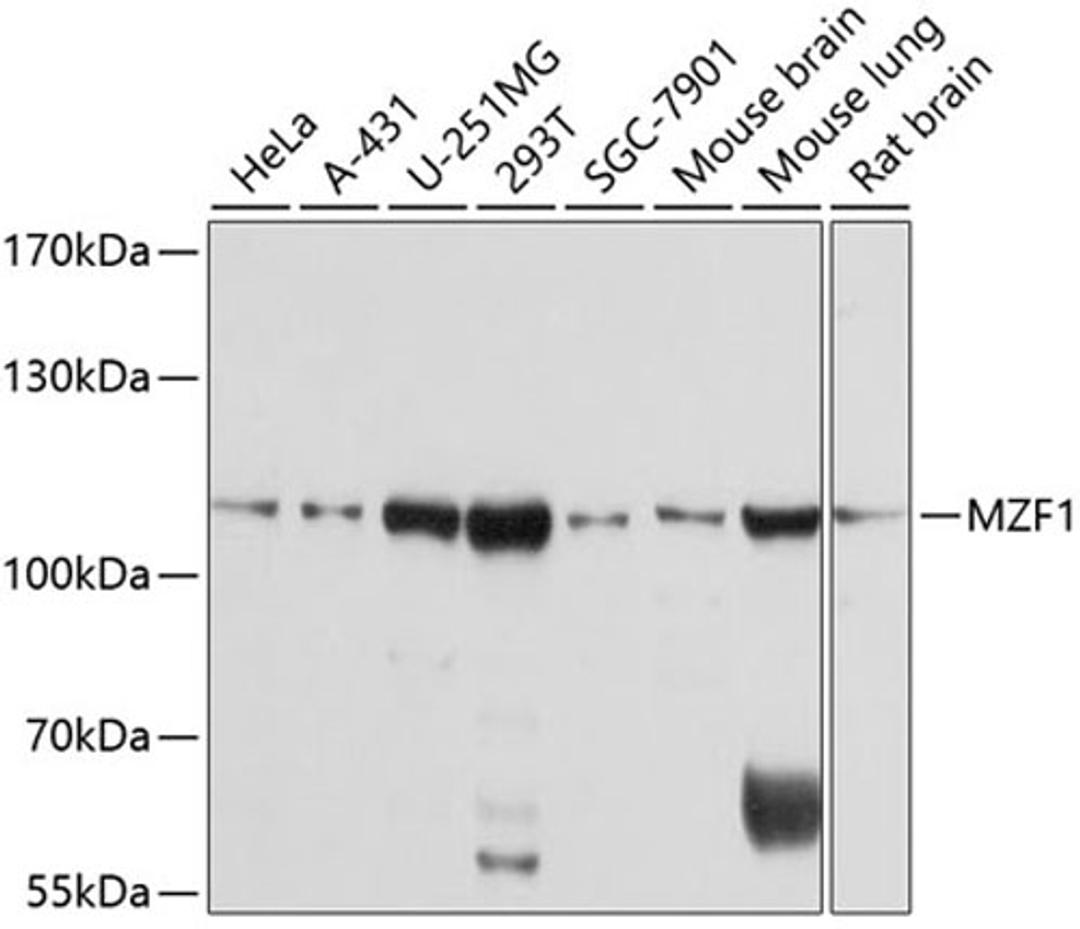 Western blot - MZF1 antibody (A10356)