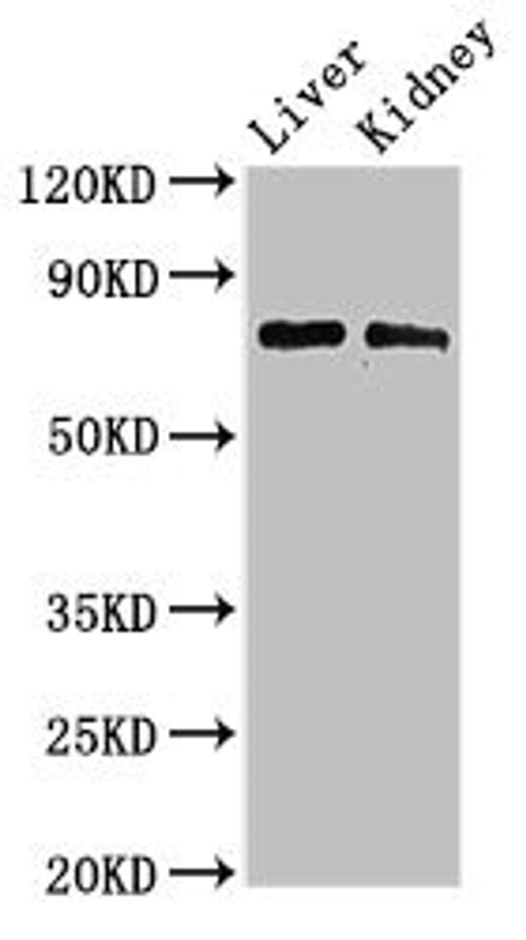 Western Blot. Positive WB detected in: Mouse liver tissue, Mouse kidney tissue. All lanes: PHF21A antibody at 3ug/ml. Secondary. Goat polyclonal to rabbit IgG at 1/50000 dilution. Predicted band size: 75, 71 kDa. Observed band size: 75 kDa. 