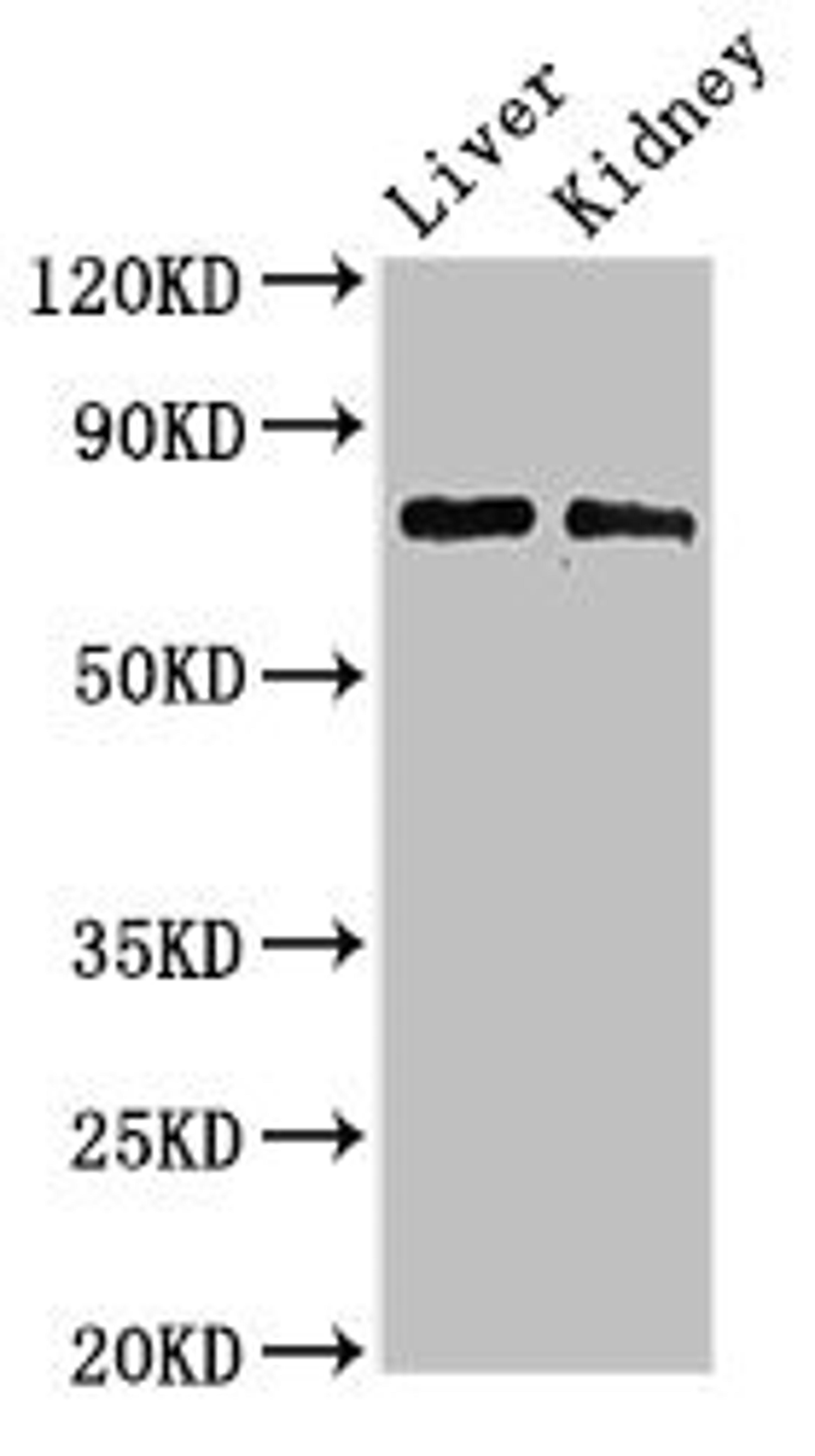 Western Blot. Positive WB detected in: Mouse liver tissue, Mouse kidney tissue. All lanes: PHF21A antibody at 3ug/ml. Secondary. Goat polyclonal to rabbit IgG at 1/50000 dilution. Predicted band size: 75, 71 kDa. Observed band size: 75 kDa. 