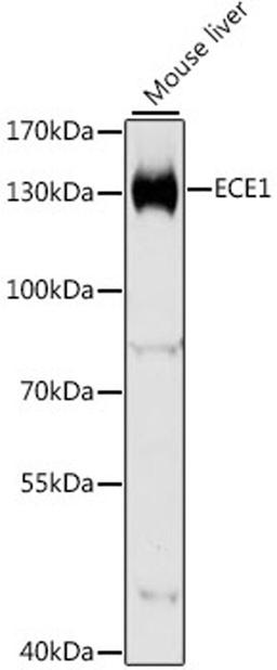 Western blot - ECE1 antibody (A5638)